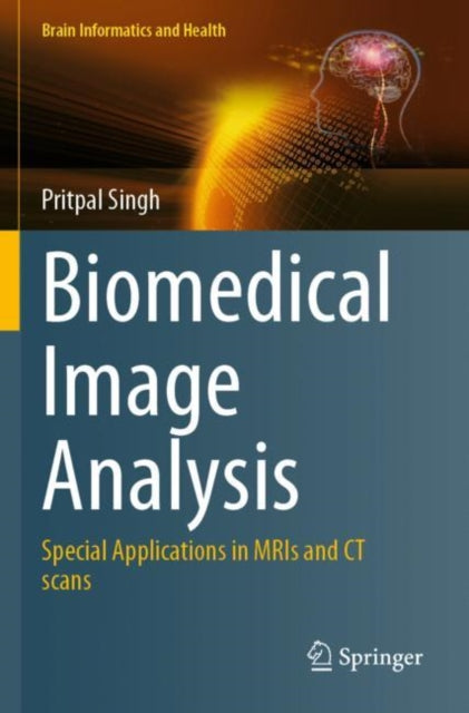 Book cover of: Biomedical Image Analysis