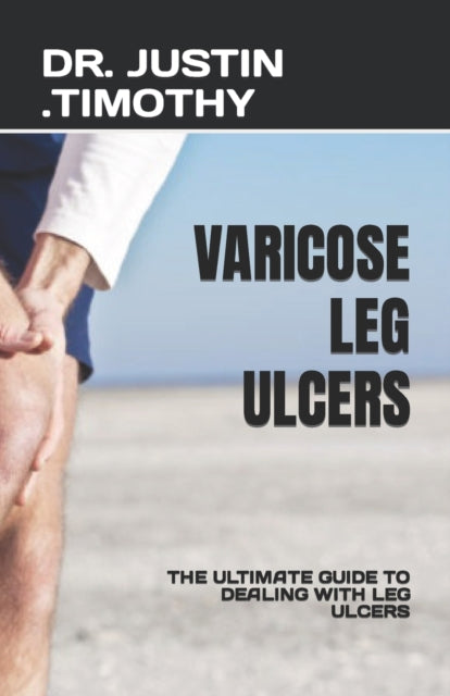 Book cover of: Varicose Leg Ulcers