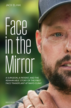 Face Transplant